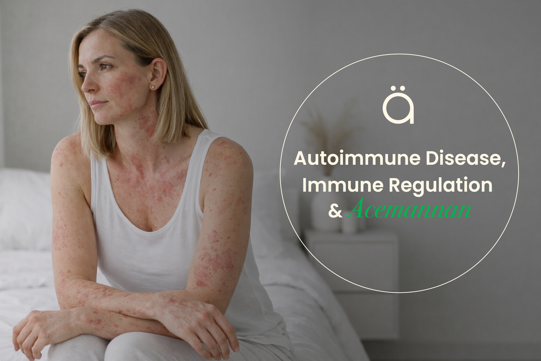 Autoimmune Disease, Immune Regulation & Acemannan